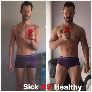 Sick vs Healthy